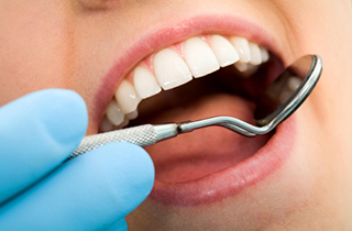 Dental Fillings in Canoga Park